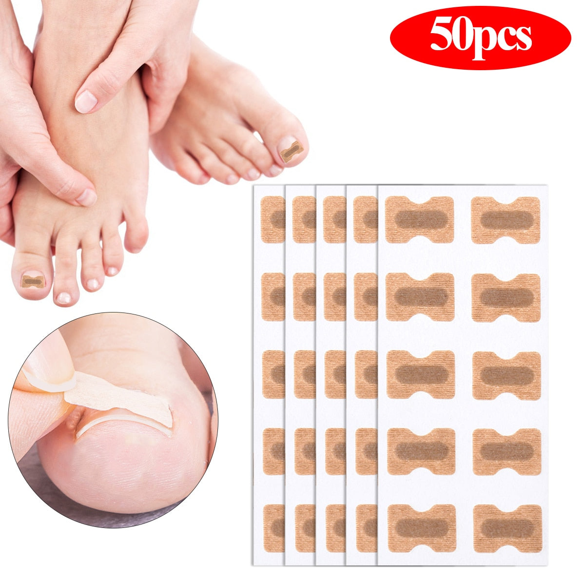Ingrown Toenail Corrector Patches - JCEE Shop