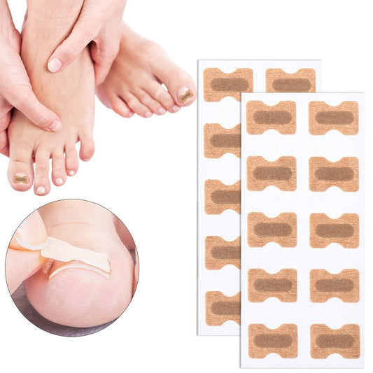 Ingrown Toenail Corrector Patches - JCEE Shop