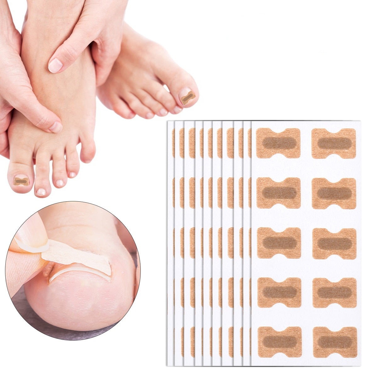 Ingrown Toenail Corrector Patches - JCEE Shop